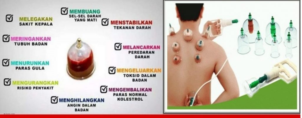 Jasa Bekam di Tegal